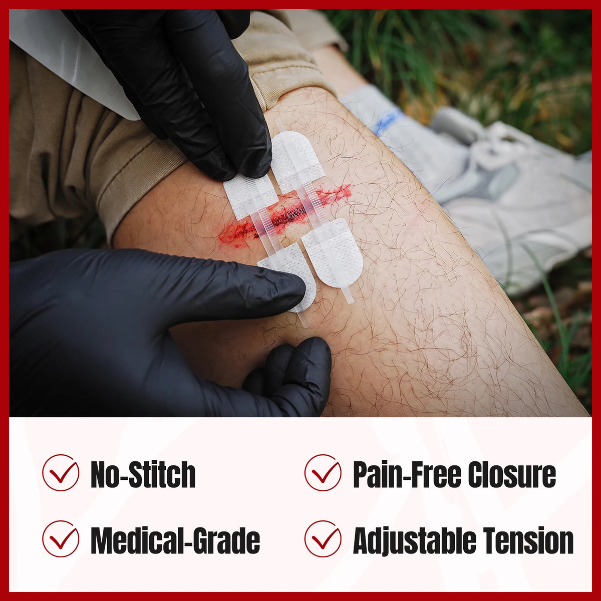 Frontier Aid Wound Kit